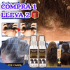Spray Caspa GRIEGO 🎁(COMPRA 1 & LLEVA 2) +Fuertes + Largo✨BYE BYE HONGO